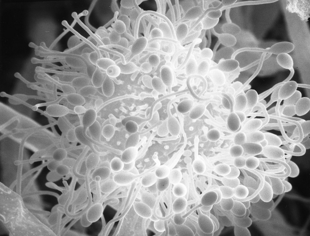 Представитель Семейства Mycotyphaceae